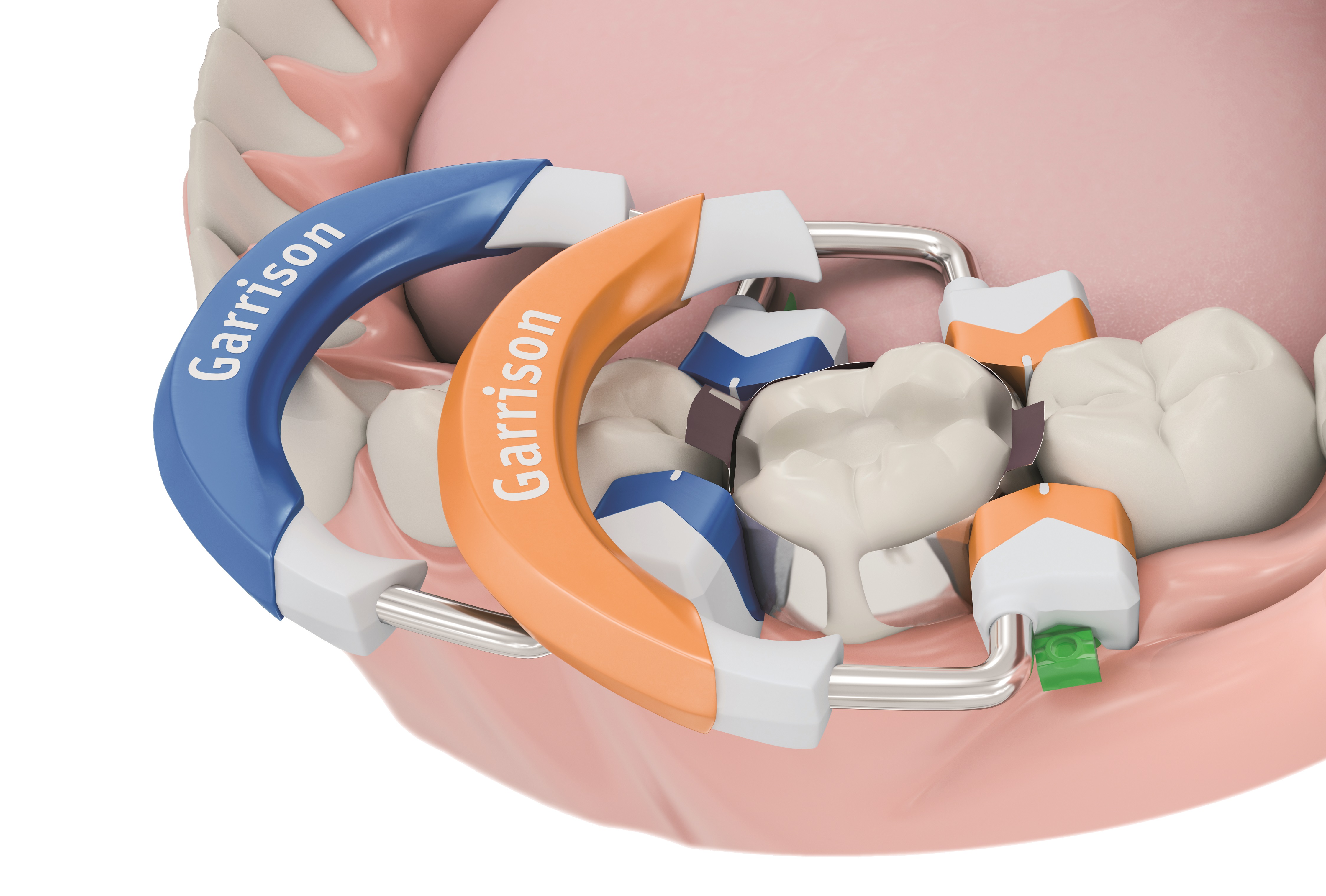 ComposiTight® 3D Fusion™ Matrix Rings Garrison Dental